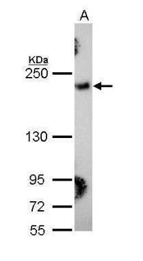 Anti-Collagen III alpha1 (C-term) Antibody
