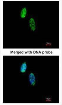 Anti-CKS-2 Antibody