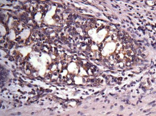 Anti-VAPA Antibody