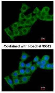 Anti-Calcium binding protein P22 (internal) Antibody