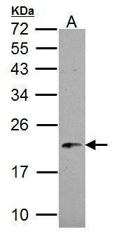 Anti-NDUFB5 Antibody