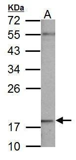 Anti-NDUFB5 Antibody