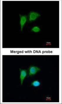 Anti-PIG3 Antibody