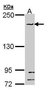 Anti-SMC1B Antibody