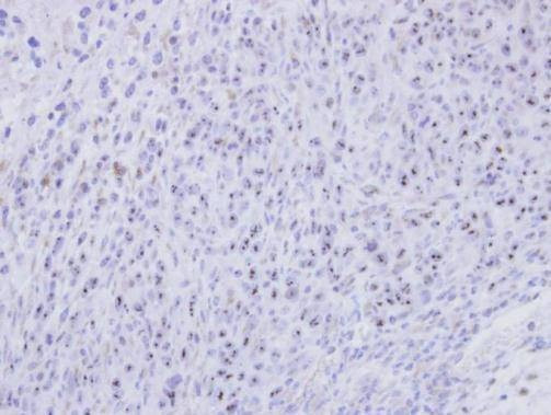 Anti-SMC1B Antibody