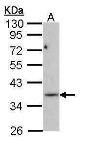 Anti-PRPS1L1 Antibody