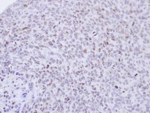 Anti-PCNP (N-term) Antibody
