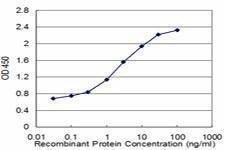 Anti-ZIC1 Antibody