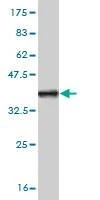 Anti-ZIC1 Antibody