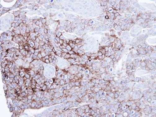 Anti-alkaline phosphatase (intestinal) Antibody