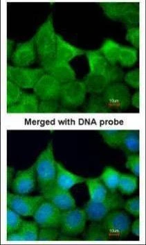 Anti-EXOC7 Antibody