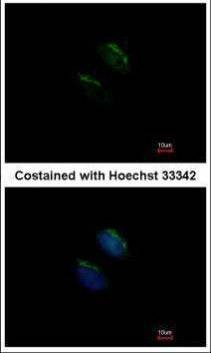 Anti-MGAT3 Antibody