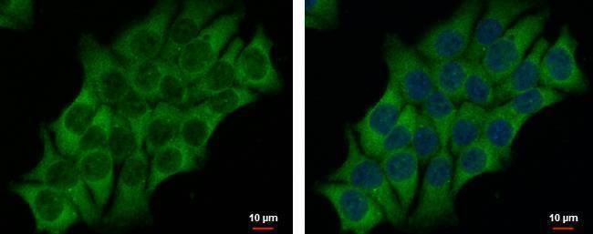 Anti-AHCYL2 Antibody
