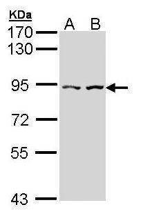 Anti-Alpha-catulin (internal) Antibody
