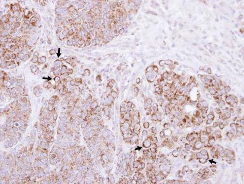 Anti-Alpha-catulin (internal) Antibody