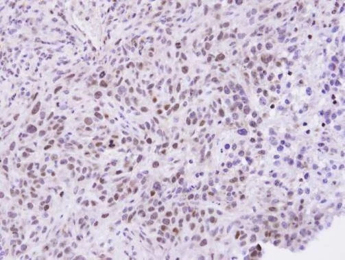 Anti-ZHX2 Antibody