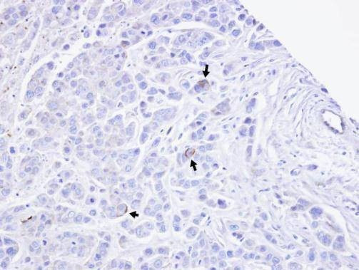Anti-TRPM2 (N-term) Antibody