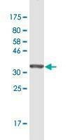 Anti-ZIC1 Antibody
