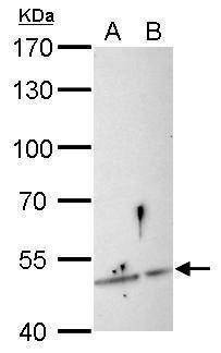 Anti-SESN3 Antibody