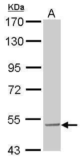Anti-SESN3 Antibody