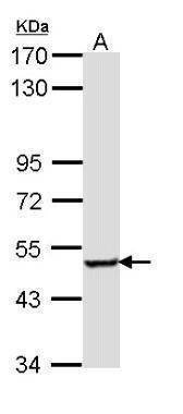 Anti-SESN3 Antibody