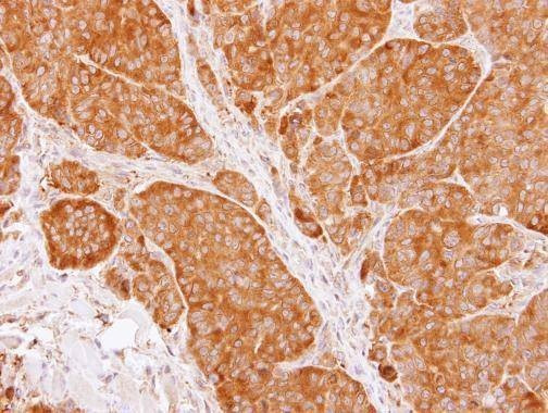 Anti-TCP1 beta Antibody