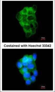 Anti-PPFIBP2 Antibody
