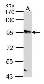 Anti-PPFIBP2 Antibody