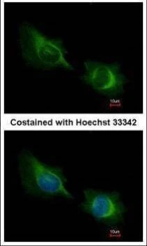 Anti-Deltex1 Antibody