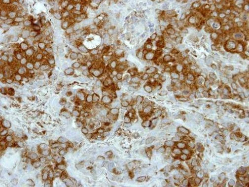 Anti-Deltex1 Antibody