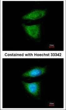 Anti-DYNC1I2 Antibody
