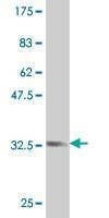 Anti-ZIC1 Antibody