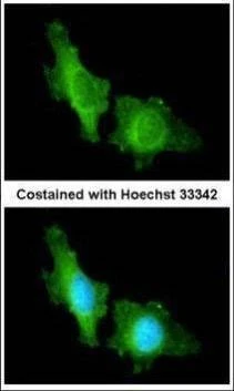Anti-CNGA2 Antibody