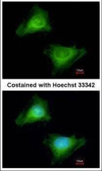 Anti-GBP3 Antibody