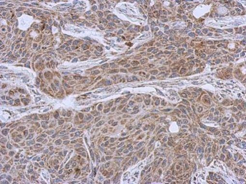Anti-DLST Antibody