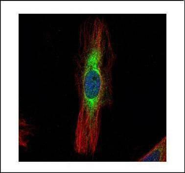 Anti-SCIN (internal) Antibody