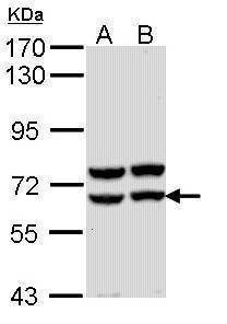 Anti-alpha amylase 2A (pancreatic) Antibody