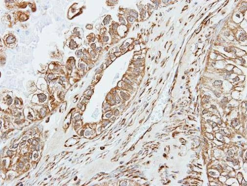 Anti-alpha amylase 2A (pancreatic) Antibody