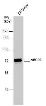 Anti-ABCD2 (internal) Antibody