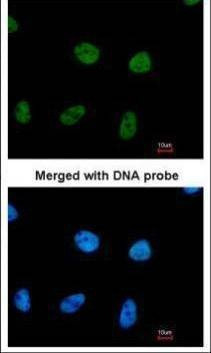 Anti-RPA32 Antibody