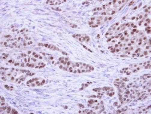 Anti-RPA32 Antibody