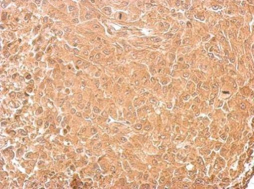 Anti-GAD65 Antibody