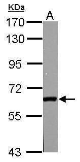 Anti-GAD65 Antibody