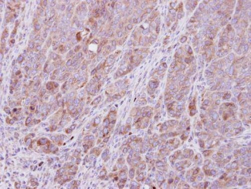Anti-ROCK1 (N-term) Antibody