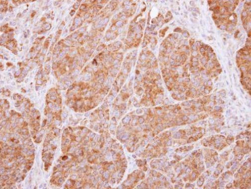 Anti-14-3-3 beta Antibody