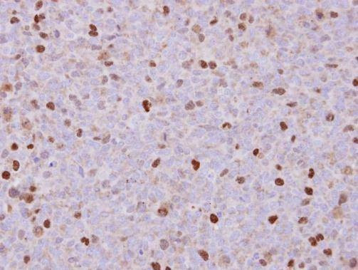 Anti-RACGAP1 (N-term) Antibody