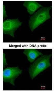 Anti-Annexin A1 Antibody