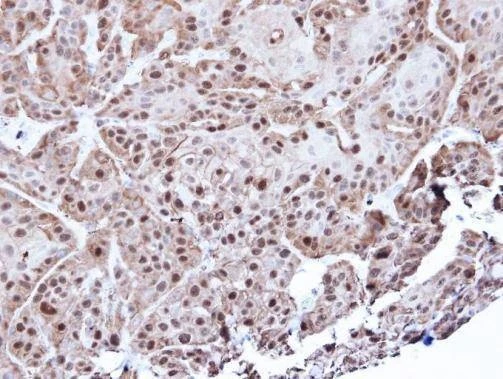 Anti-Annexin A1 Antibody