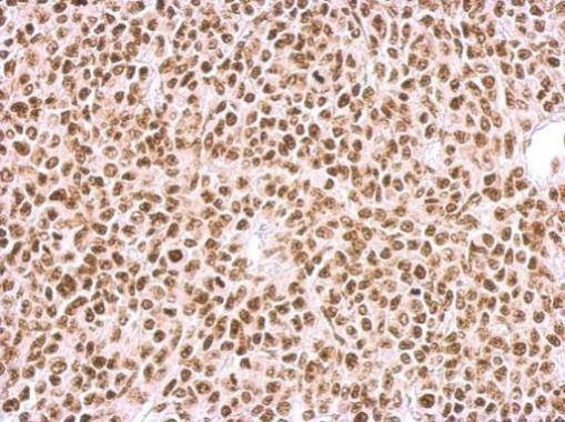 Anti-BCCIP Antibody