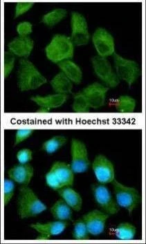 Anti-TPP1 Antibody